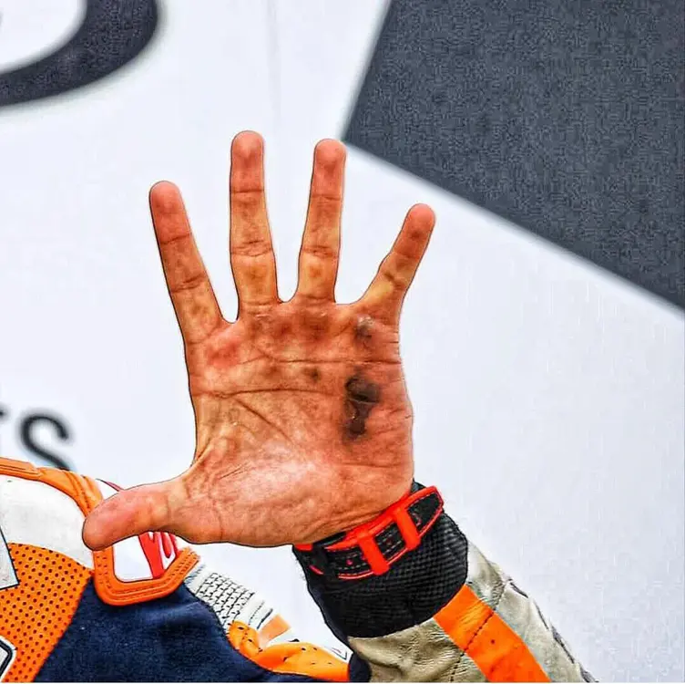 insane-marc-marquezs-hand-after-german-gp-win-v0-p4cra8l8wx831.thumb.webp.2b553f890ae6aab191747c268c463dec.webp